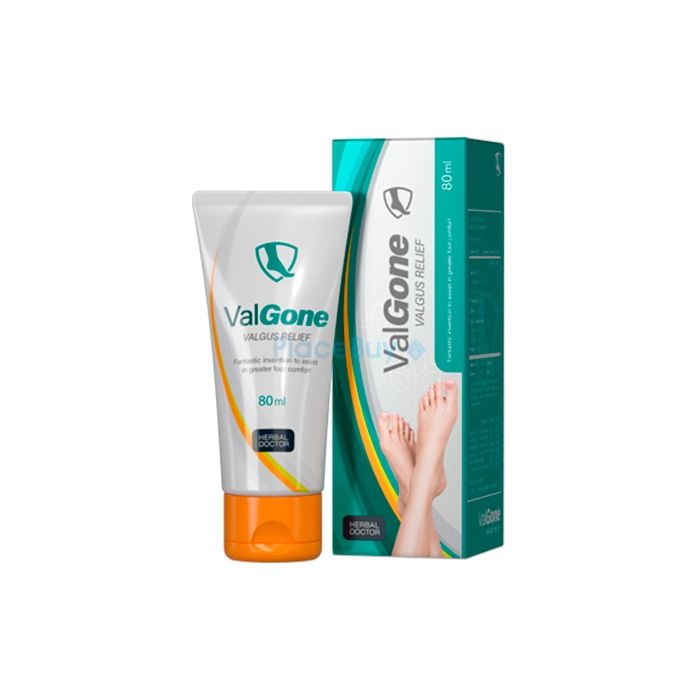 ValGone cream to combat hallux valgus