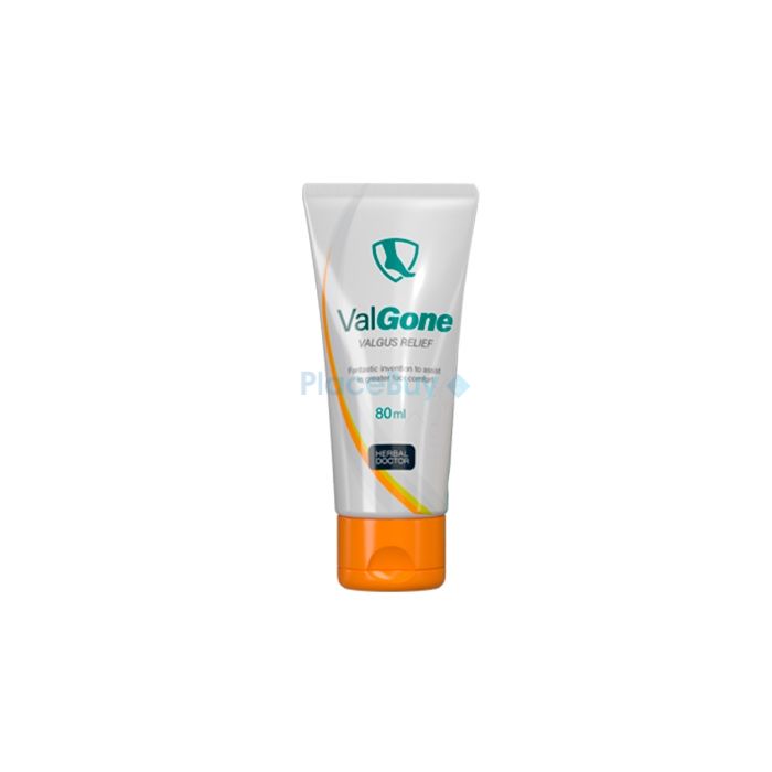 ValGone cream to combat hallux valgus