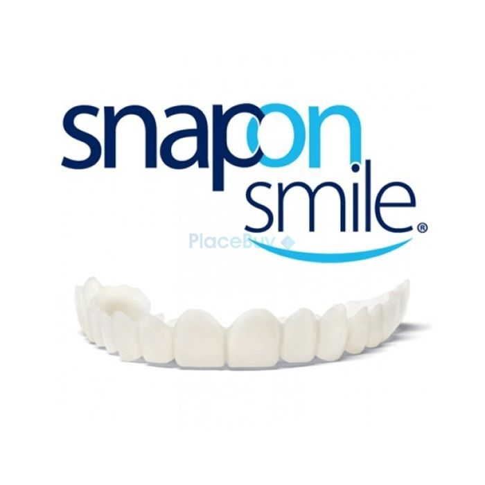 Snap-On Smile veneers